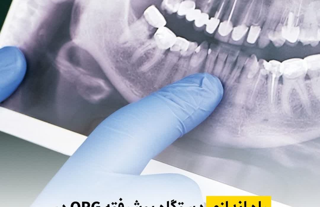  راه‌اندازی دستگاه پیشرفته OPG در بیمارستان امام حسن مجتبی (ع) داراب